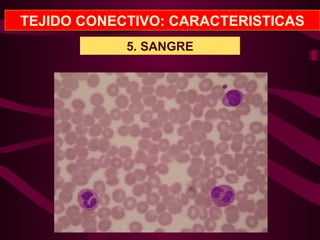 TEJIDO CONECTIVO: CARACTERISTICAS
5. SANGRE
 