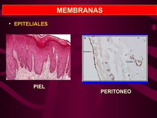 MEMBRANAS
• EPITELIALES
PIEL
PERITONEO
 