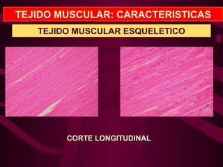 TEJIDO MUSCULAR: CARACTERISTICAS
TEJIDO MUSCULAR ESQUELETICO
CORTE LONGITUDINAL
 