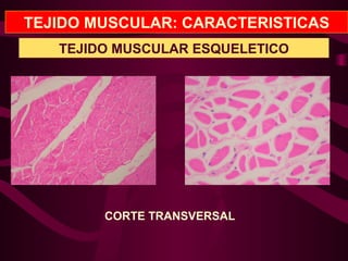 TEJIDO MUSCULAR: CARACTERISTICAS
TEJIDO MUSCULAR ESQUELETICO
CORTE TRANSVERSAL
 