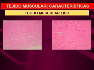 TEJIDO MUSCULAR: CARACTERISTICAS
TEJIDO MUSCULAR LISO
 