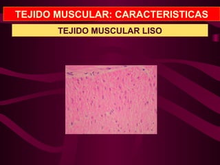 TEJIDO MUSCULAR: CARACTERISTICAS
TEJIDO MUSCULAR LISO
 