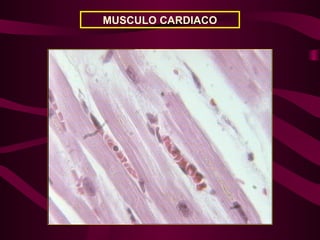 MUSCULO CARDIACO
 
