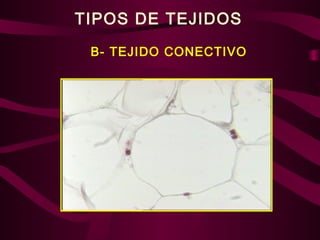 TIPOS DE TEJIDOS
B- TEJIDO CONECTIVO
 