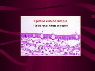 Túbulo renal: Ribete en cepillo
Epitelio cúbico simple
 
