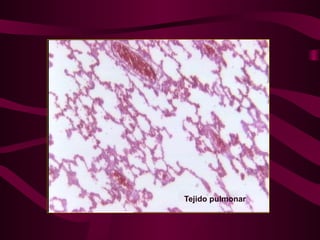 Tejido pulmonar
 