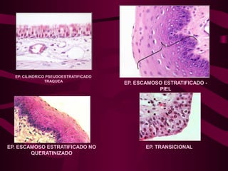 EP. CILINDRICO PSEUDOESTRATIFICADO
TRAQUEA
EP. ESCAMOSO ESTRATIFICADO -
PIEL
EP. ESCAMOSO ESTRATIFICADO NO
QUERATINIZADO
EP. TRANSICIONAL
 