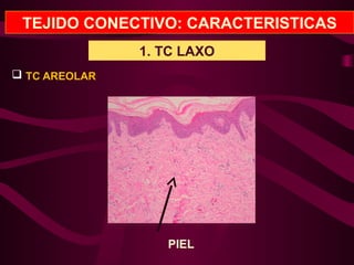 TEJIDO CONECTIVO: CARACTERISTICAS
1. TC LAXO
 TC AREOLAR
PIEL
 