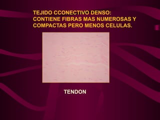 TEJIDO CCONECTIVO DENSO:
CONTIENE FIBRAS MAS NUMEROSAS Y
COMPACTAS PERO MENOS CELULAS.
TENDON
 