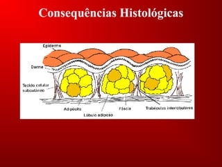 Consequências Histológicas
 
