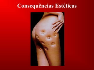 Consequências Estéticas
 