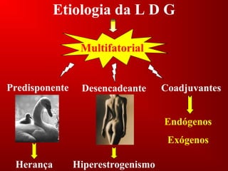Etiologia da L D G
Multifatorial
CoadjuvantesPredisponente Desencadeante
Herança Hiperestrogenismo
Endógenos
Exógenos
 