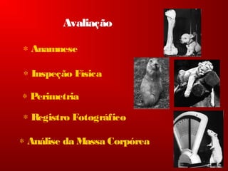 Avaliação
∗ Anamnese
∗ Inspeção Física
∗ Perimetria
∗ Registro Fotográfico
∗ Análise da Massa Corpórea
 