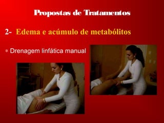 Propostas de Tratamentos
2- Edema e acúmulo de metabólitos
∗ Drenagem linfática manual
 