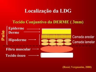 Localização da LDG
Tecido Conjuntivo da DERME ( 3mm)Tecido Conjuntivo da DERME ( 3mm)
Epiderme
Derme
Camada areolar
Camada lamelar
Hipoderme
Fibra muscular
Tecido ósseo
(Rossi; Vergnanim, 2000)
 