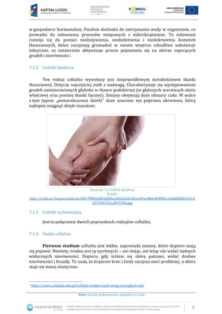 3
Kurs: Zasady wykonywania zabiegów na ciało
w gospodarce hormonalnej. Finalnie dochodzi do zatrzymania wody w organizmie, co
prowadzi do zaburzenia procesów związanych z mikrokrążeniem. To natomiast
rozwija się do postaci niedożywienia, niedotlenienia i niedokrwienia komórek
tłuszczowych, które zaczynają gromadzić w swoim wnętrzu szkodliwe substancje
toksyczne, co ostatecznie aktywizuje proces pojawiania się na skórze szpecących
grudek i nierówności1.
7.1.2 Cellulit lipidowy
Ten rodzaj cellulitu wywołany jest nieprawidłowym metabolizmem tkanki
tłuszczowej. Dotyczy najczęściej osób z nadwagą. Charakteryzuje się występowaniem
grudek umiejscowionych głęboko w tkance podskórnej (w głębszych warstwach skóry
właściwej oraz poniżej tkanki łącznej). Zmiany obejmują duże obszary ciała. W walce
z tym typem „pomarańczowej skórki” duże znacznie ma poprawa ukrwienia, którą
najlepiej osiągnąć dzięki masażom.
Rysunek 7.2 Cellulit lipidowy
Źródło:
http://ocdn.eu/images/pulscms/ODc7MDQsMCxhMSwxMjI5LGEzNzswNiwzMjAsMWMy/a6ddb8802165c4
2557b4572ccd075786.jpg
7.1.3 Cellulit cyrkulacyjny
Jest to połączenie dwóch poprzednich rodzajów cellulitu.
7.1.4 Stadia cellulitu
Pierwsze stadium cellulitu jest lekkie, zapowiada zmiany, które dopiero mają
się pojawić. Niestety, trudno jest ją wychwycić – ani stojąc, ani leżąc nie widać żadnych
widocznych nierówności. Dopiero, gdy ściśnie się skórę palcami, widać drobne
nierówności i bruzdy. To znak, że krążenie krwi i limfy zaczyna mieć problemy, a skóra
staje się mniej elastyczna.
1 http://www.cellulite.info.pl/cellulit-wodny-czyli-wrog-szczuplych-ud/
 