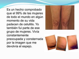 Es un hecho comprobado
que el 99% de las mujeres
de todo el mundo en algún
momento de su vida
padecen de celulitis. Yo
también fui parte de ese
grupo de mujeres. Vivía
constantemente
preocupada y consternada
por la imagen que me
devolvía el espejo.
 