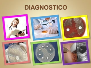 Celulitis Infecciosa