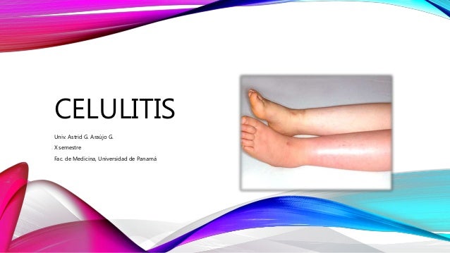 tratamiento de celulitis abscedada en niños