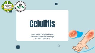 Celulitis
Cátedra de Cirugía General
Estudiante: Marietta Abrego
Décimo semestre
 