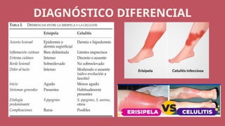 Comprehensive Pediatric Cellulitis: Etiology, Diagnosis, and Treatment ...