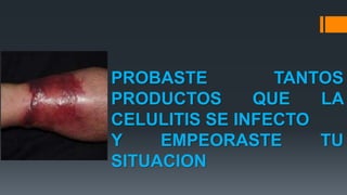 PROBASTE TANTOS
PRODUCTOS QUE LA
CELULITIS SE INFECTO
Y EMPEORASTE TU
SITUACION