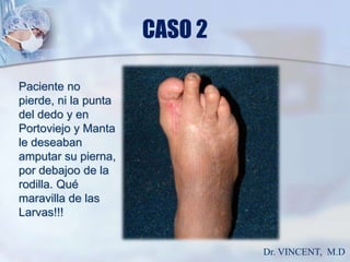 CASO 2Paciente no pierde, ni la punta del dedo y en Portoviejo y Manta le deseaban amputar su pierna, por debajoo de la rodilla. Qué maravilla de las Larvas!!!Dr. VINCENT,  M.D