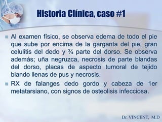 Historia Clínica, caso #1Al examen físico, se observa edema de todo el pie que sube por encima de la garganta del pie, gran celulitis del dedo y ¾ parte del dorso. Se observa además; uña negruzca, necrosis de parte blandas  del dorso, placas de aspecto tumoral de tejido blando llenas de pus y necrosis.RX de falanges dedo gordo y cabeza de 1er metatarsiano, con signos de osteolisis infecciosa.Dr. VINCENT,  M.D