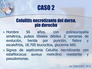 CASO 2Celulitis necrotizante del dorso,pie derechoHombre 56 años, con polineuropatía simétrica, pulsos tíbiales débiles 2 semanas de evolución, herida por punción, fiebre y escalofríos, 18.700 leucocitos, glucemia 660. Signos de septicemia Celulitis necrotizante con estafilococusaureusmeticilino resistente y pseudomonas.Dr. VINCENT,  M.D