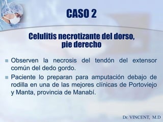 CASO 2Celulitis necrotizante del dorso,pie derechoObserven la necrosis del tendón del extensor común del dedo gordo.Paciente lo preparan para amputación debajo de rodilla en una de las mejores clínicas de Portoviejo y Manta, provincia de Manabí.Dr. VINCENT,  M.D