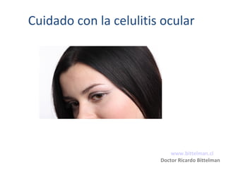 Cuidado con la celulitis ocular
www.bittelman.cl
Doctor Ricardo Bittelman
 