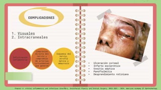 1. Visuales
2. Intracraneales
COMPLICACIONES
Infiltración
inflamatoria
Compresión
directa del
nervio y
compromiso
de arterias
circundantes
que generan
Isquemia del
nervio,
atrofia
óptica y
amaurosis • Ulceración corneal
• Infarto esclerótico
• Uveítis séptica
• Panoftalmitis
• Desprendimiento retiniano
Chapter 4: orbital inflammatory and infectious disorders. Oculofacial Plastic and Orbital Surgery. BSCS 2023 – 2024. American Academy Of Ophthalmology
 