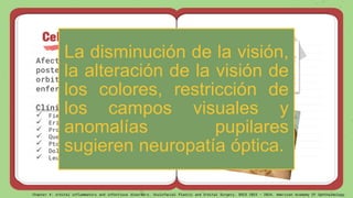 Celulitis Orbitaria
Afecta estructuras
posteriores al tabique
orbitario y ocurre como una
enfermedad secundaria.
Clínica:
 Fiebre
 Eritema
 Proptosis
 Quemosis
 Ptosis
 Dolor a los movimientos oculares
 Leucocitosis (75% de los casos)
La disminución de la visión,
la alteración de la visión de
los colores, restricción de
los campos visuales y
anomalías pupilares
sugieren neuropatía óptica.
Chapter 4: orbital inflammatory and infectious disorders. Oculofacial Plastic and Orbital Surgery. BSCS 2023 – 2024. American Academy Of Ophthalmology
 