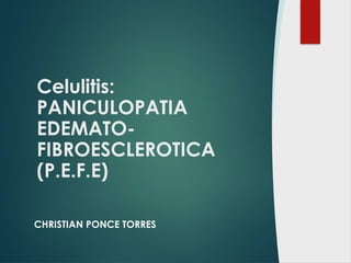 Celulitis_PEFE presentacion medicina.pptx