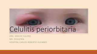 Celulitis periorbitaria
DRA. GRECCE CALERO
MR. PEDIATRÍA
HOSPITAL CARLOS ROBERTO HUEMBES
 