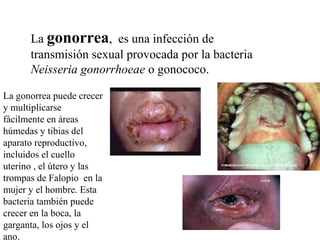 La gonorrea, es una infección de
transmisión sexual provocada por la bacteria
Neisseria gonorrhoeae o gonococo.
La gonorrea puede crecer
y multiplicarse
fácilmente en áreas
húmedas y tibias del
aparato reproductivo,
incluidos el cuello
uterino , el útero y las
trompas de Falopio en la
mujer y el hombre. Esta
bacteria también puede
crecer en la boca, la
garganta, los ojos y el
ano.
 