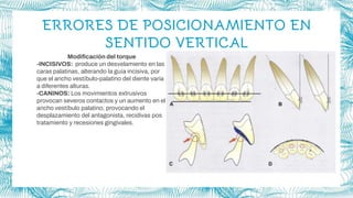 ERRORES DE POSICIONAMIENTO EN
SENTIDO VERTICAL
Modificación del torque
-INCISIVOS: produce un desvelamiento en las
caras palatinas, alterando la guía incisiva, por
que el ancho vestíbulo-palatino del diente varia
a diferentes alturas.
-CANINOS: Los movimientos extrusivos
provocan severos contactos y un aumento en el
ancho vestíbulo palatino, provocando el
desplazamiento del antagonista, recidivas pos
tratamiento y recesiones gingivales.
 