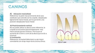 CANINOS
A) Ubicación mesiodistal
Referencia: la parte mas prominente de la cara
vestibular que coincide con la cúspide, desplazado
ligeramente hacia mesial, por lo que tendrá una
posición desplazada hacia mesial
B) Posicionamiento vertical
No se puede utilizar su altura como referencia, la
cúspide se encuentra aproximadamente mas
hacia oclusal que los incisivos. Por lo que se
aumenta de 0.5mm a 1mm de la altura que se dio a
incisivos.
C) Inclinación
Referencia: el bracket debe tener su eje mayor
coincidente con el eje mayor de la corona clínica.
 