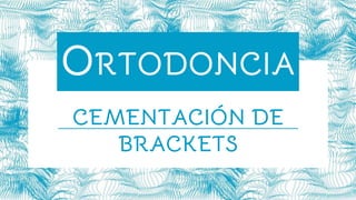 ORTODONCIA
CEMENTACIÓN DE
BRACKETS
 
