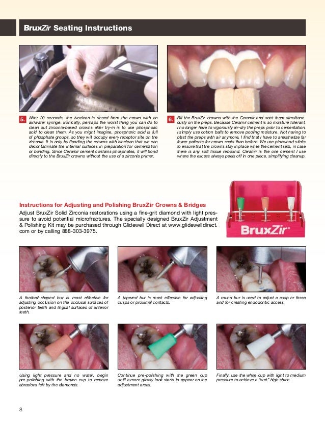 Cementation of Zirconia crowns