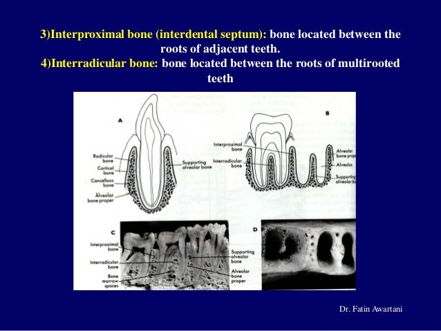 cement bone interradicular bone