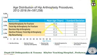 Age Distribution of Hip Arthroplasty Procedures,
2012-2018 (N=597,258)
 