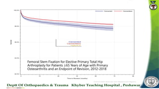 Femoral Stem Fixation for Elective Primary Total Hip
Arthroplasty for Patients ≥65 Years of Age with Primary
Osteoarthritis and an Endpoint of Revision, 2012-2018
 