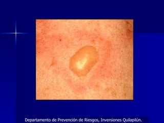 Departamento de Prevención de Riesgos, Inversiones Quilapilún. 