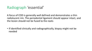 Cemento osseus dysplasia (Doctor Faris Alabeedi MSc, MMedSc, PgDip, BDS ...