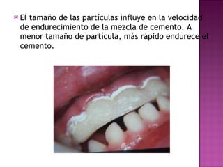 El tamaño de las partículas influye en la velocidad de endurecimiento de la mezcla de cemento. A menor tamaño de partícula, más rápido endurece el cemento. 