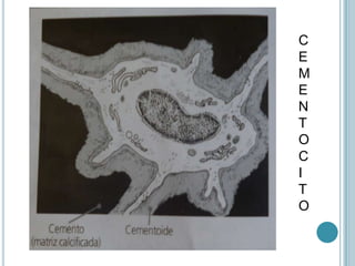 C
E
M
E
N
T
O
C
I
T
O
 