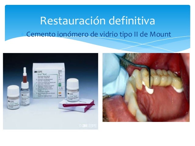 Cementos en odontología