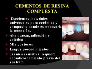 CEMENTOS DE RESINA COMPUESTA Excelentes materiales universales para cerámica y composite donde es necesaria la retención. Alta dureza, adhesión y estética Más costosos Largos procedimientos Técnica sensitiva: requiere acondicionamiento previo del sustrato 