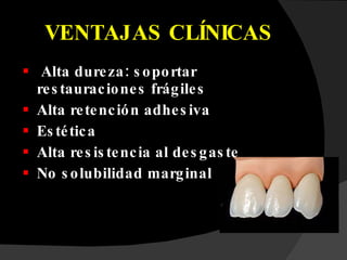 VENTAJAS CLÍNICAS Alta dureza: soportar restauraciones frágiles Alta retención adhesiva Estética Alta resistencia al desgaste No solubilidad marginal 